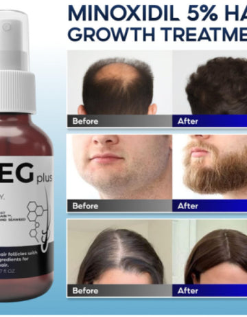 Feg Plus Hair Growth Spray ( Pack Of 1 )