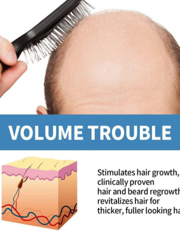 Minoxi Roll-on Hair Treatment, Hair Oil for Dry Damaged Hair and Growth ( Pack Of 2 )