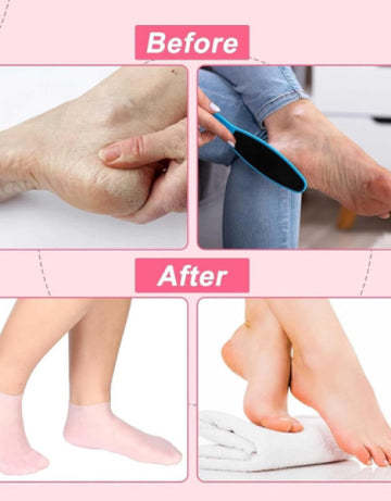 Silicone Moisturizing Socks for Dry Cracked Feet Women